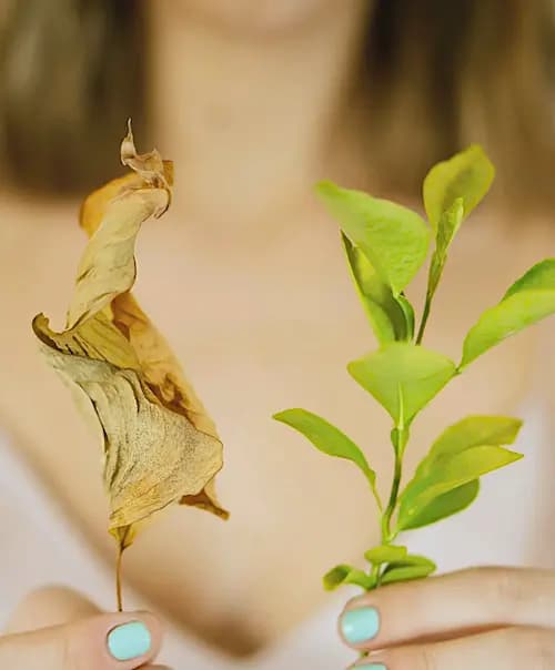 Biostimulation mit Radiesse oder Sculptra Bild